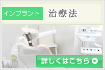 インプラント治療法